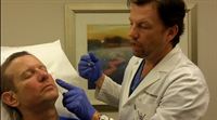 Dr Robert Sigal gets facial filler injections by Dr Byron Poindexter