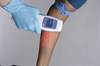 Vein illumination with the AccuVein AV400