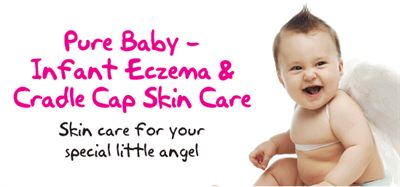 cradle cap and infant eczema