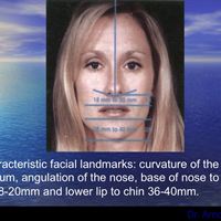 Dr. Arnold Klein - lip photo