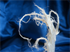 Asbestos