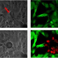 CanceCancer cells before (a) and after (b) magnetic field assisted photothermal destruction.
