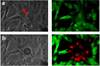 CanceCancer cells before (a) and after (b) magnetic field assisted photothermal destruction.