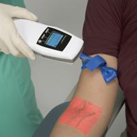 AccuVein AV300 and patient