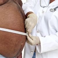 Patient with belly fat