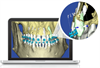 SureSmile 3-D orthodontic planning software with cutaway of root location in bone 