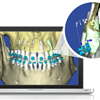 SureSmile 3-D orthodontic planning software with cutaway of root location in bone 