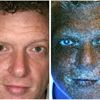 Man fotograferad i UV-kamera