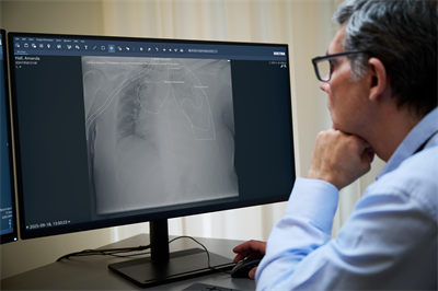Radiologist reading lungXray in Sectra solution