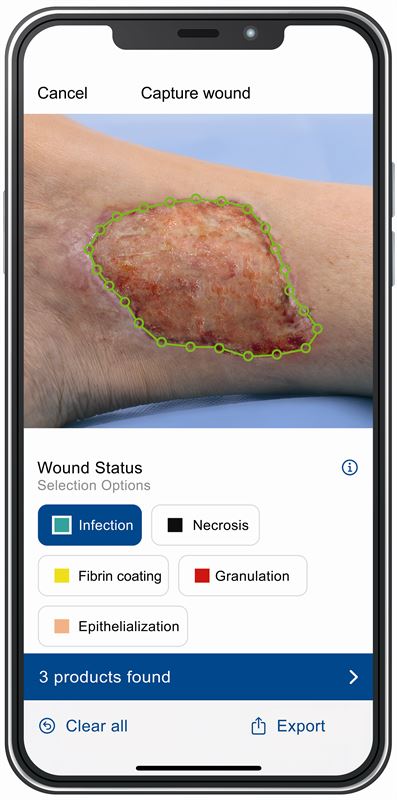 Cutimed Wound Navigator App