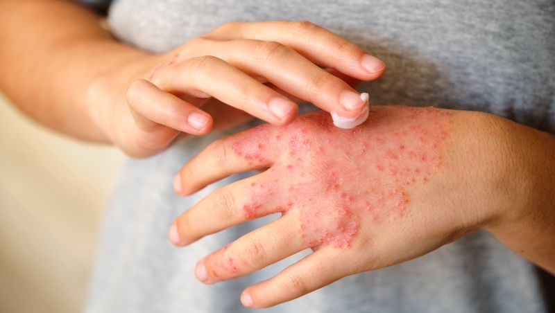 TIRmed Pharma reser 48 MSEK.jpg