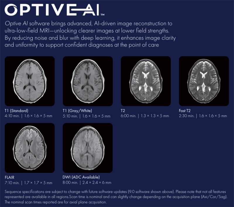 Optive AI Brain Scan.png