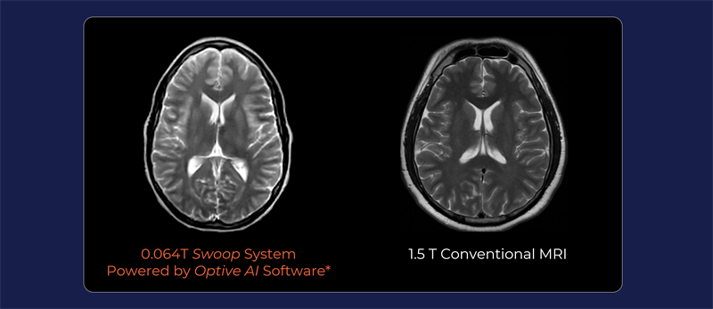 second pic 0.64t vs 1.5t.png